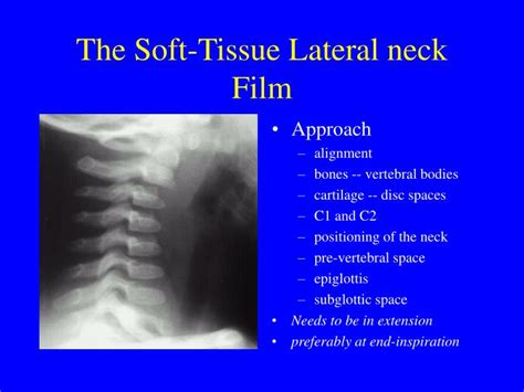 soft tissue neck x ray positioning.